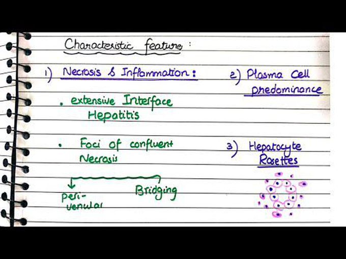 Pathogenesis of Autoimmune hepatitis