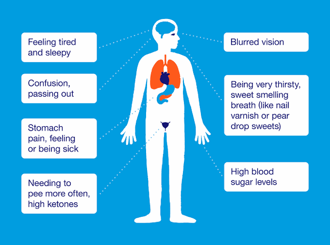 Symptoms of diabetic ketoacidosis