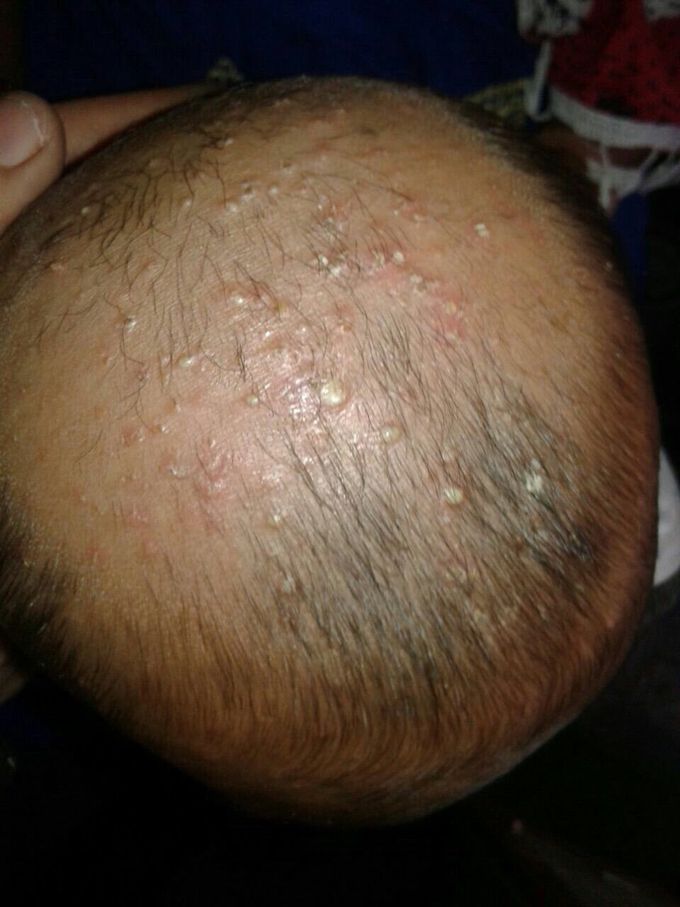 Dx and Rx ??