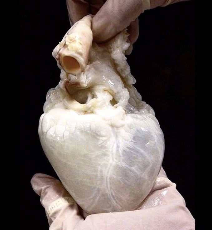 Ghost Heart | Fort Bend MD