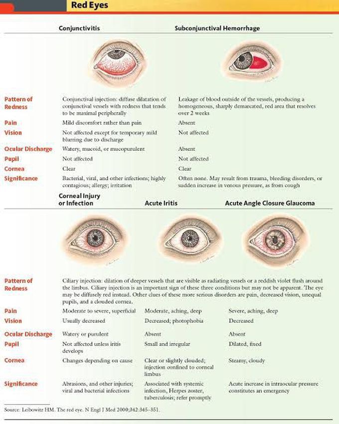 Conditions with Red Eye