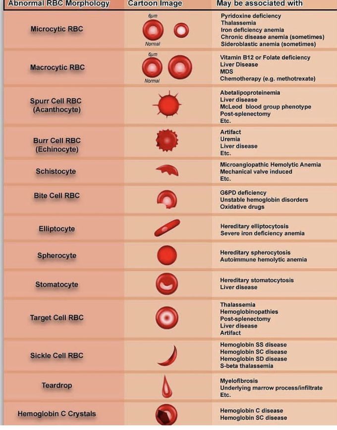 Abnormal RBCs Morphology 👨‍⚕️ 💉