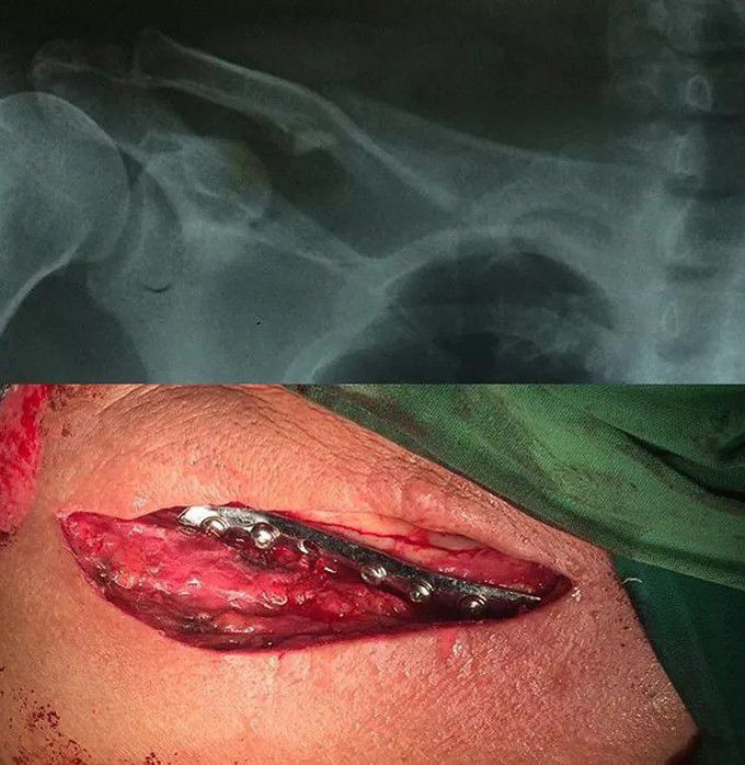 orthopedic surgery