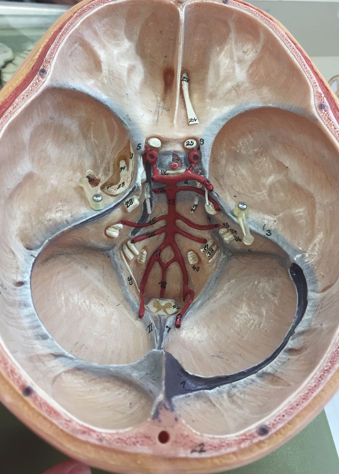 Circle of Willis