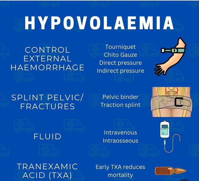 Hypovolemia Management