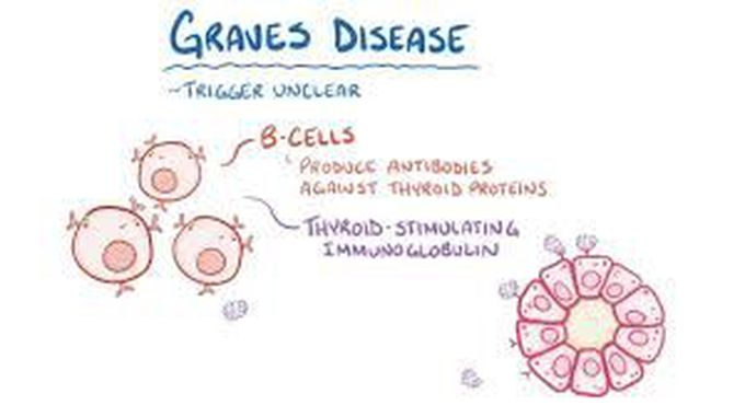 What is graves disease
