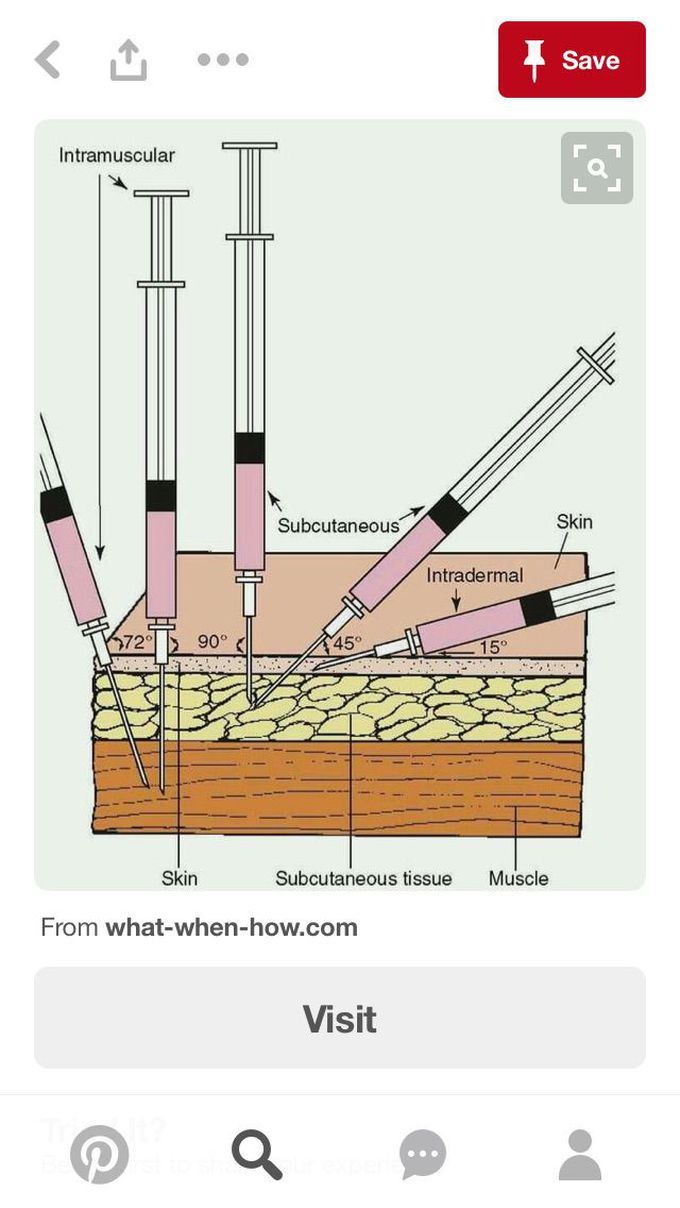 Injections