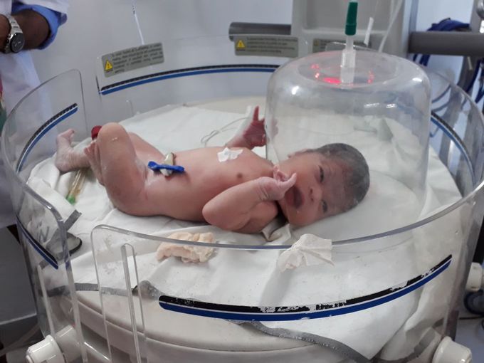 A recently normal delivered baby