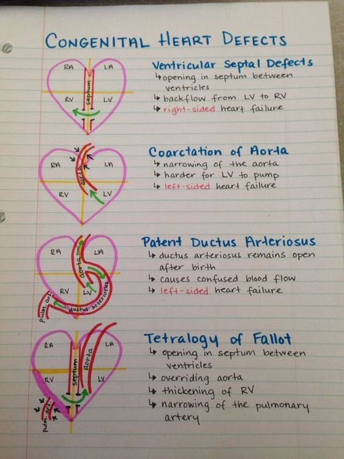 Congenital heart diseases