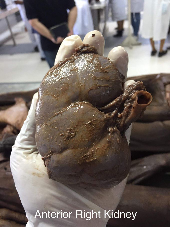 Kidney study😏👍