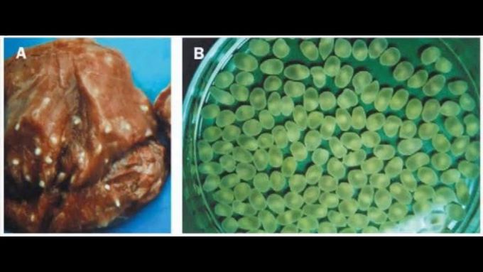 Taenia solium- Disease, symptoms, morphology and life cycle