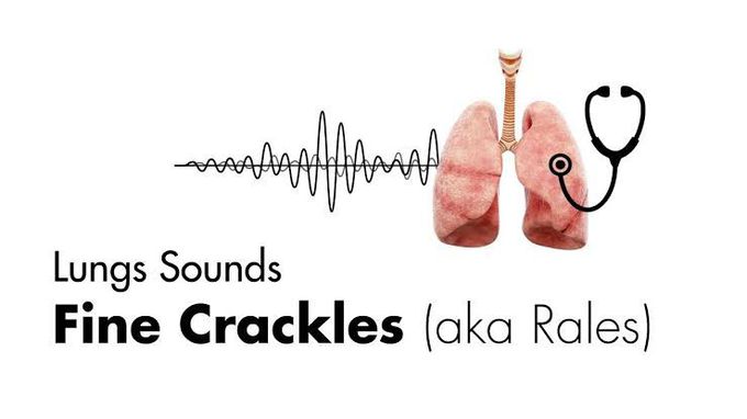 Crackles