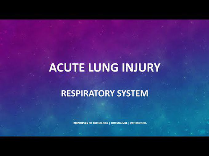 Pathology of Acute Respiratory Distress Syndrome (ARDS)
