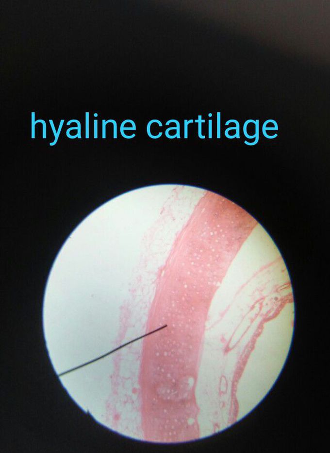 Cartilage