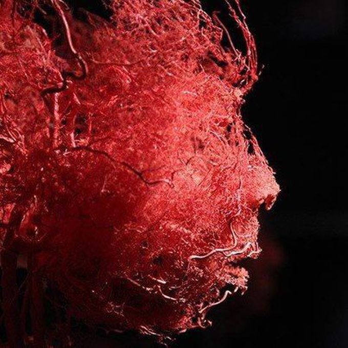 The blood vessels in human head