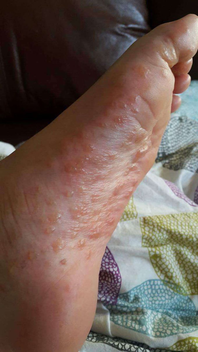 ❓Mystery Diagnosis ❓