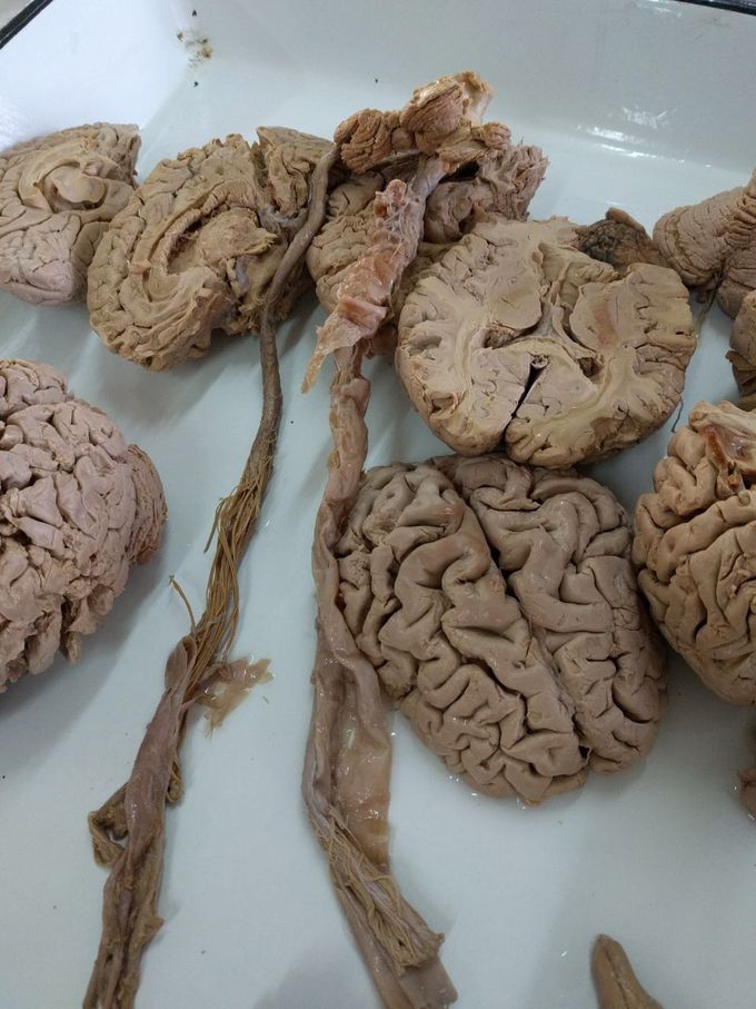 Neuroanatomy