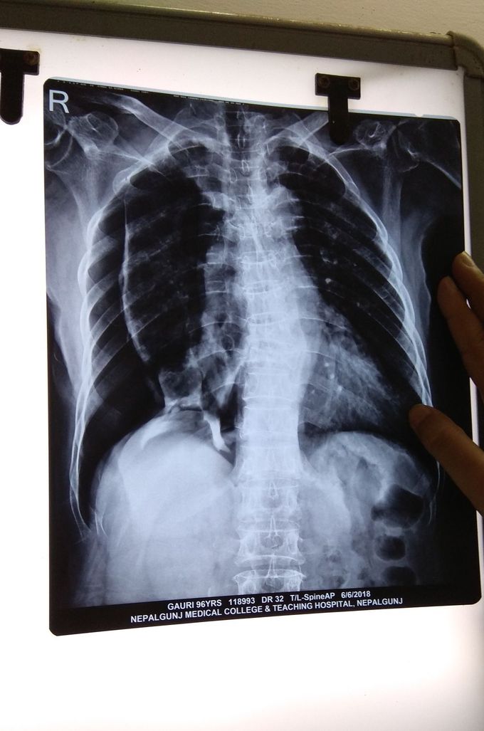 What is this case?