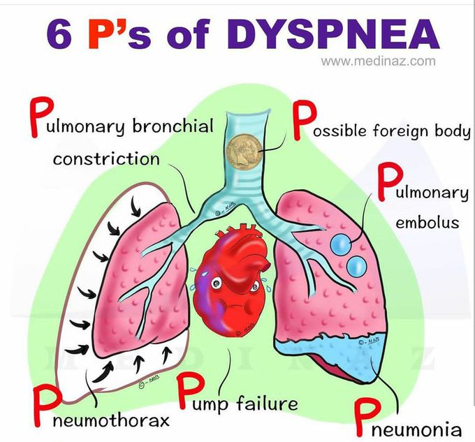 Dyspnea