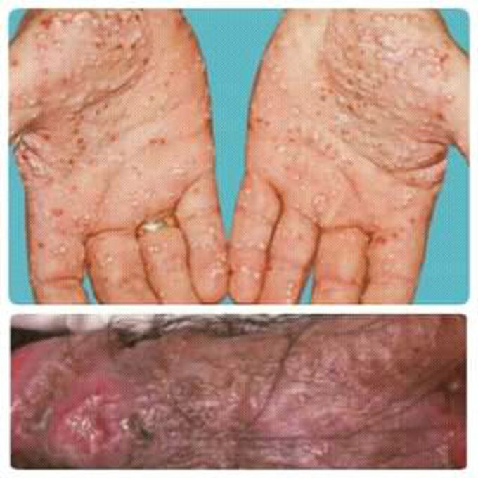 Please diagnosis and treatment !!!