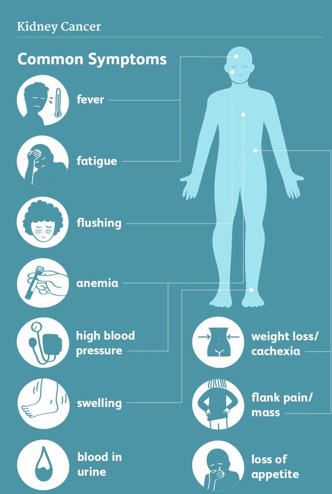 Symptoms of Kidney cancer
