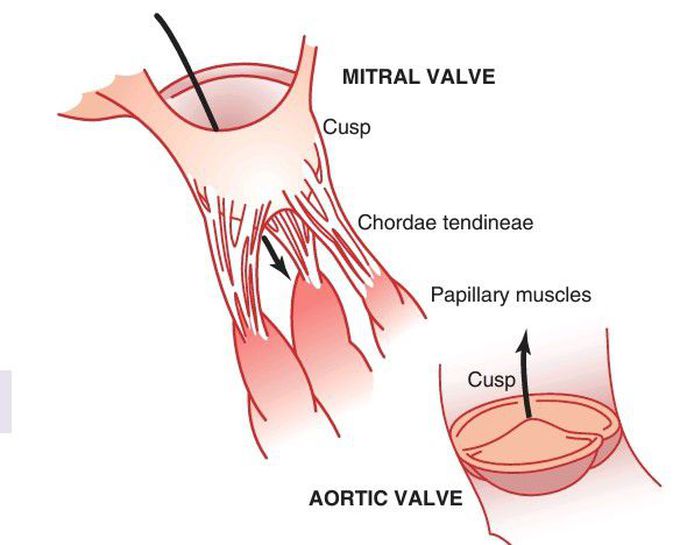 Cardiac valves