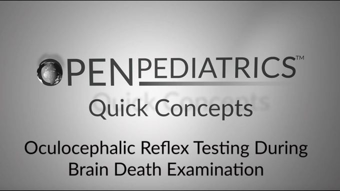 The Doll's Eye Reflex- Looking for brain death