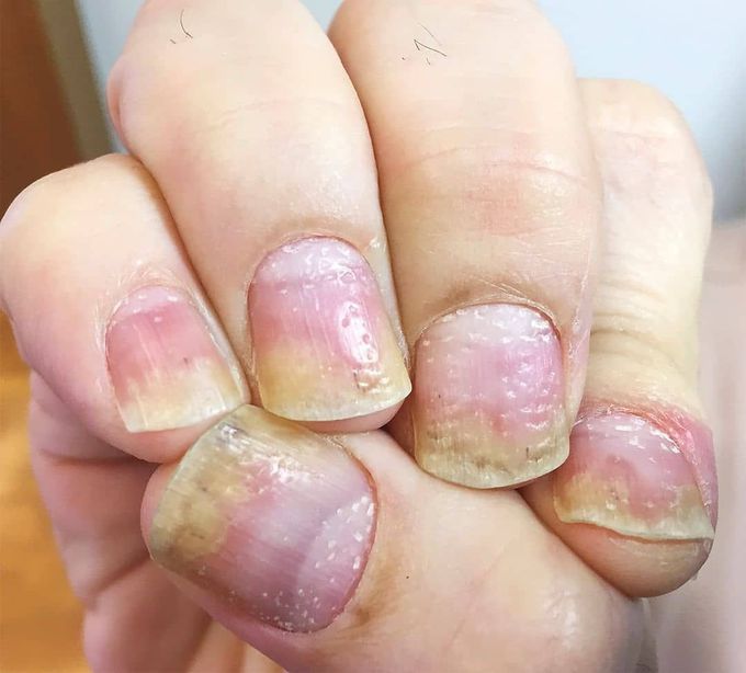 Images in Clinical Medicine: