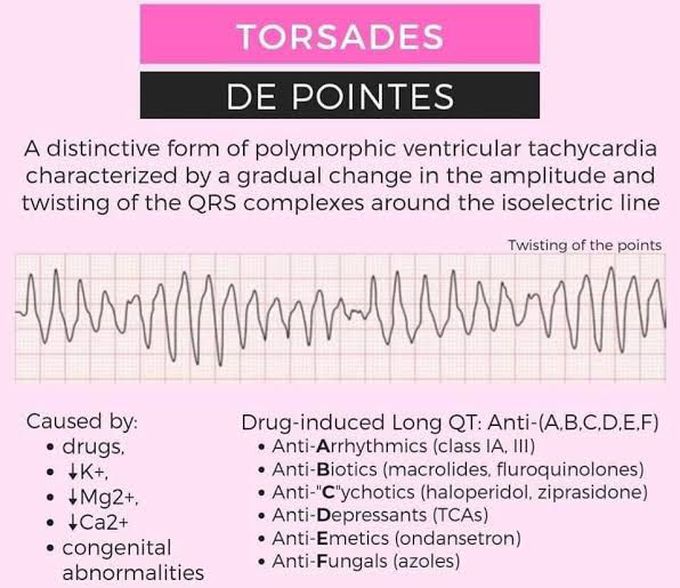 Torsades De Pointes