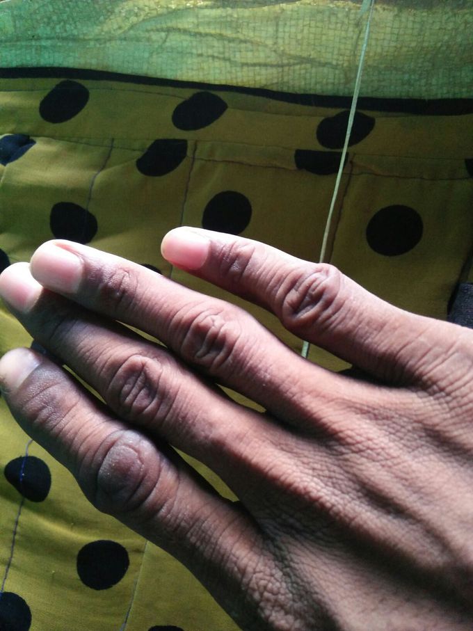 Please diagnose the condition!!!!