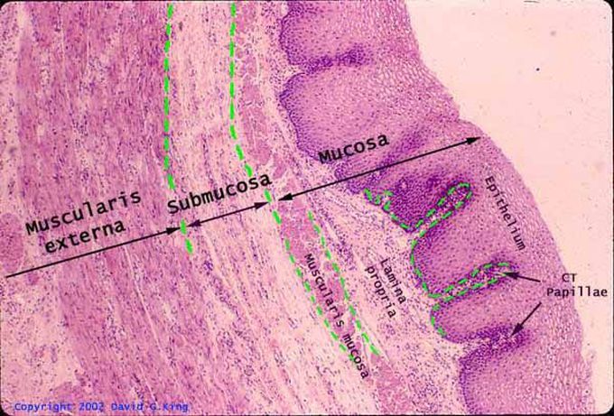 Tissue under micro.s
