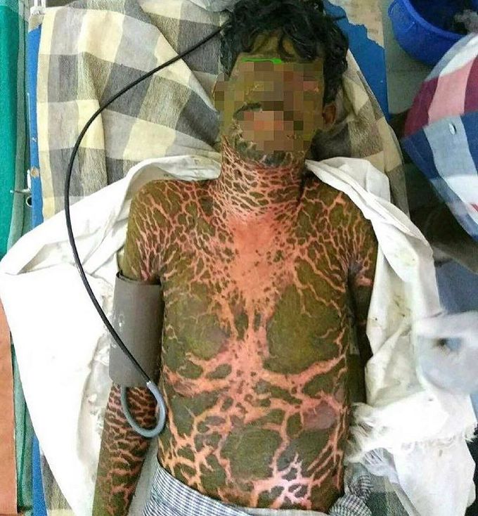 Diagnose this condition