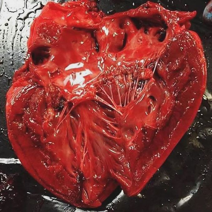 The heart from the inside