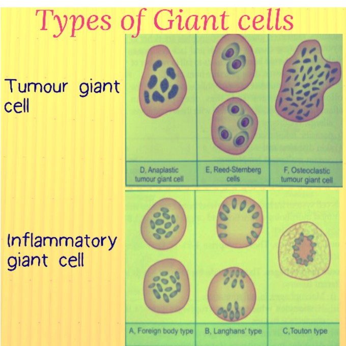 Types of Giant cell