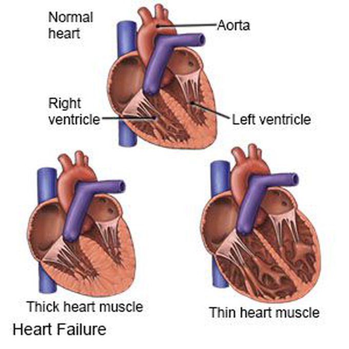 Cardiology