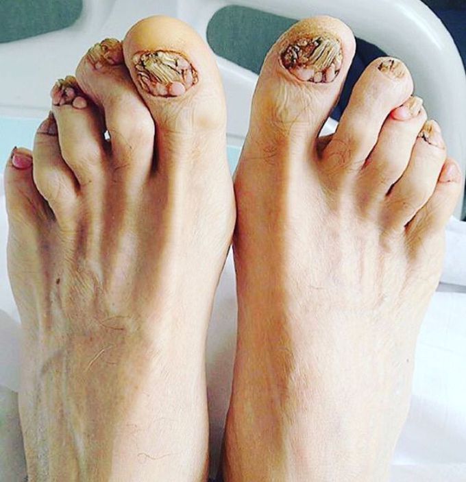 What is the name of this condition?
