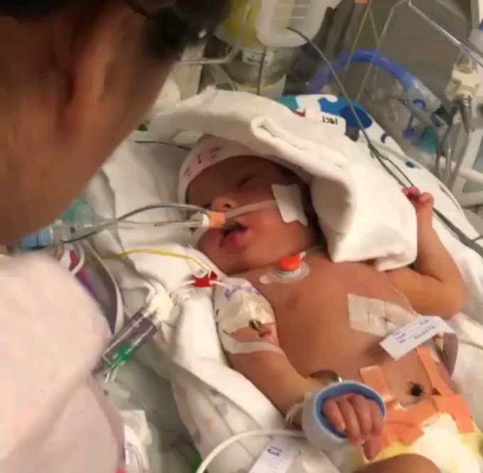 Congenital diaphragmatic hernia