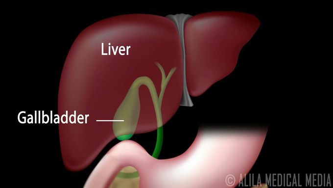 Gall bladder-Surgery (Animated)