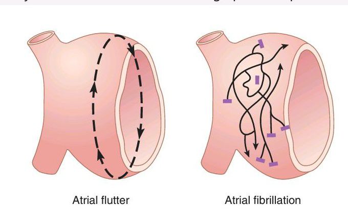 Pathway of cardiac impulses