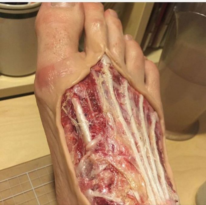 Can you identify the tendon?