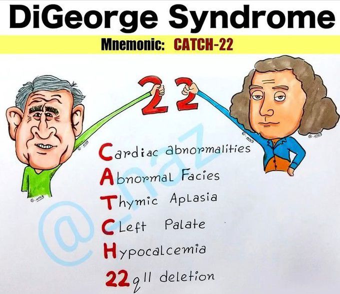 Mnemonic for the DiGeorge syndrome