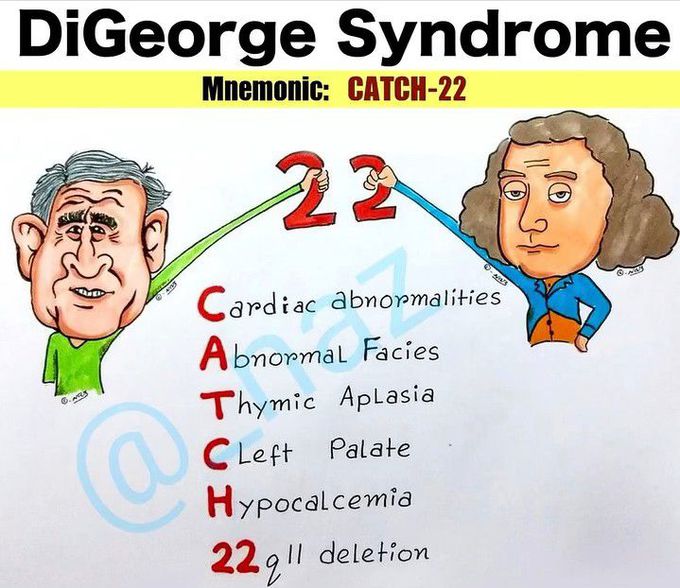 Mnemonic for the DiGeorge syndrome