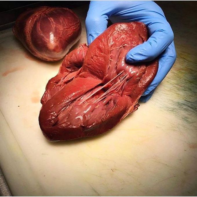 Dissected heart!