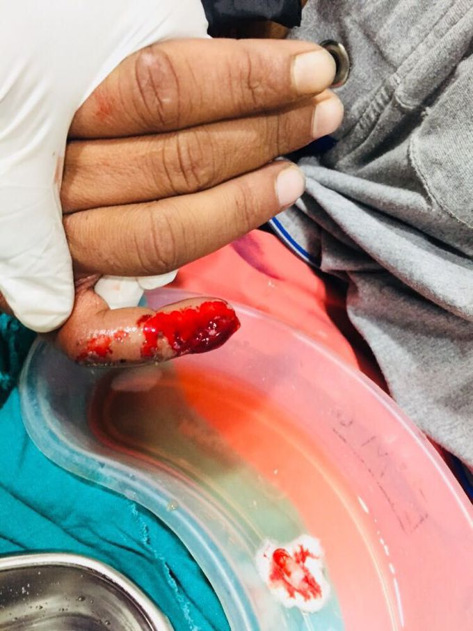 Surgery