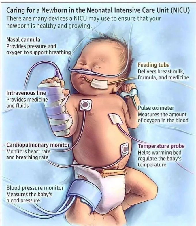 NICU Guidelines