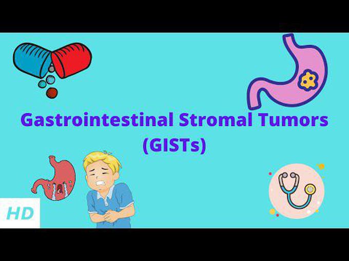 Gastrointestinal Stromal Tumors: Overview