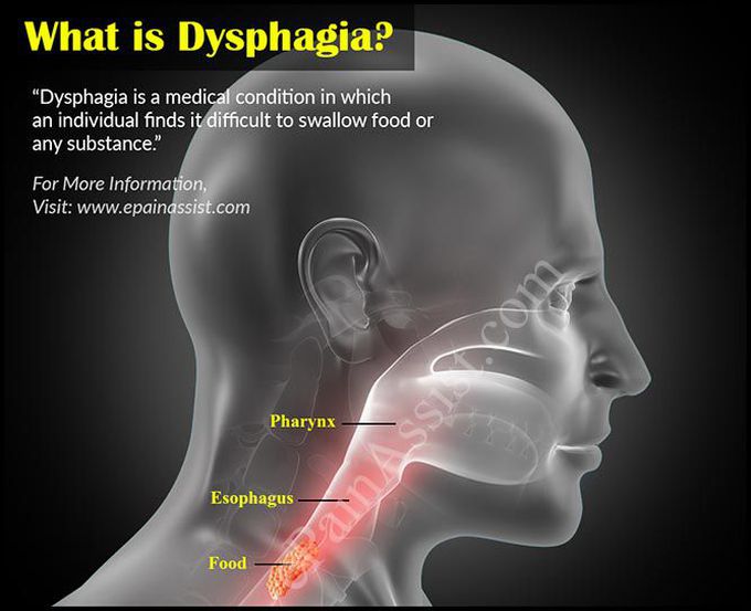 Dysphagia