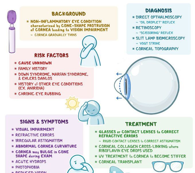 Treatment for Keratoconus