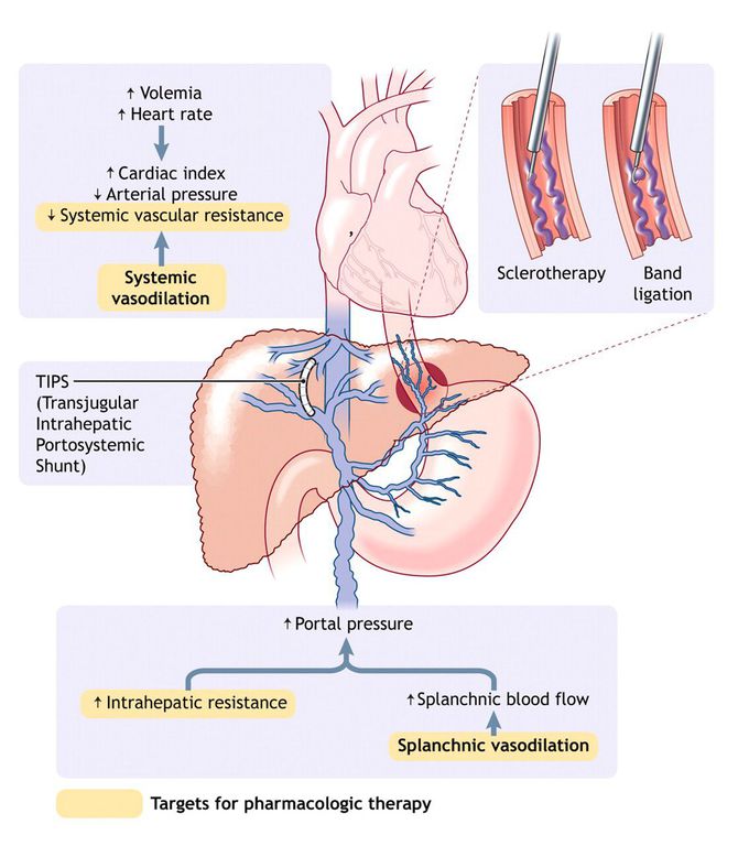 Pathophysiology of portal hypertension in cirrhosis