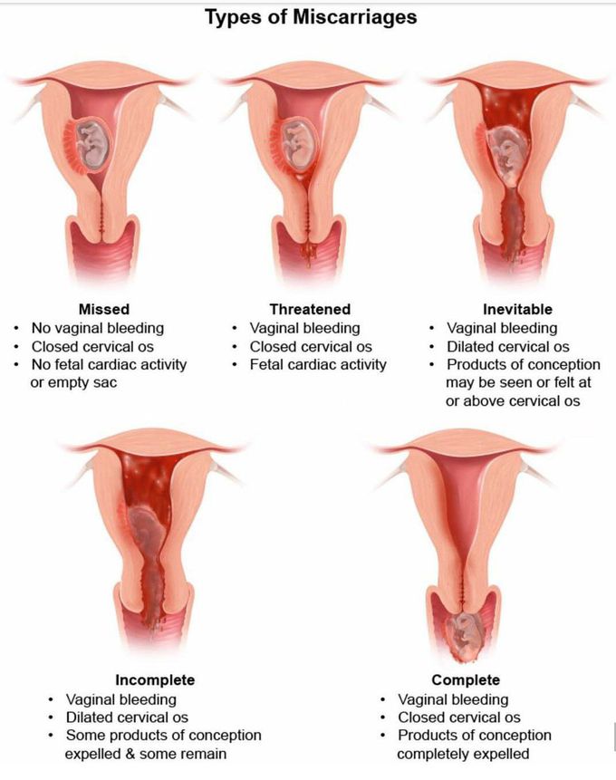 Gynaecology